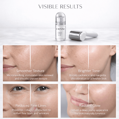 Micro-Infusion Facial System