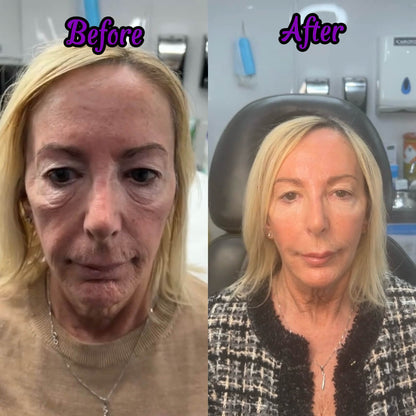 Cienne Calcium Anti-Aging Multi Balm